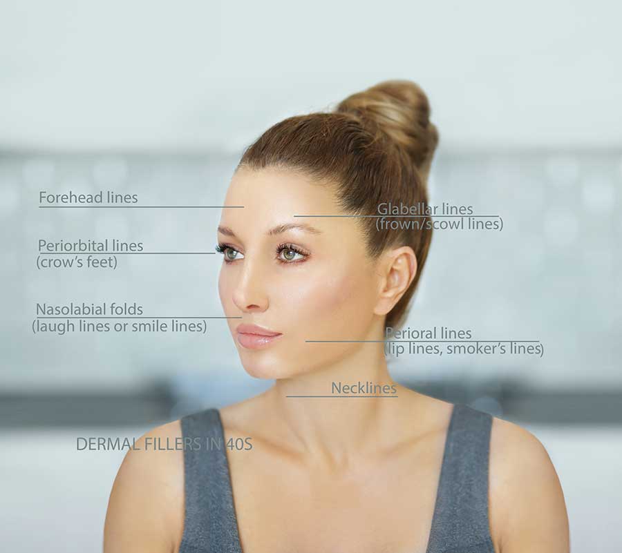 A Quick Guide to Facial (Dermal) Fillers Overview of Features and Benefits